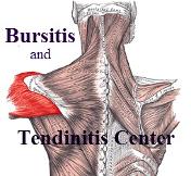 Bursitis and Tendinitis Info